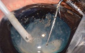 C'è troppa poca attenzione nei riguardi degli occhi dei cavalli: la parola a Riccardo Stoppini